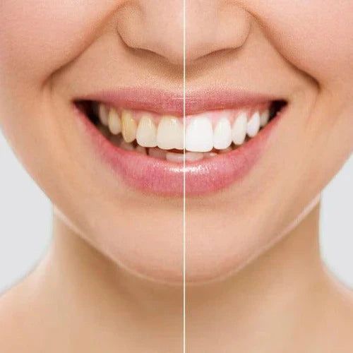 Lápiz Blanqueador Dental Dazzling White ✨: ¡Renueva Tu Sonrisa! 😁